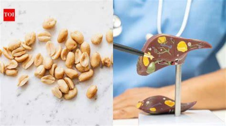 Can peanuts cause liver damage?