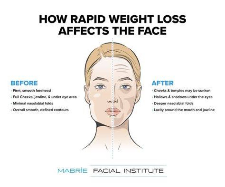 Does the face lose weight first?