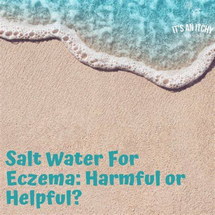 Is Cool water good for eczema?