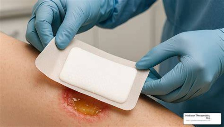 What can be put on an open wound?
