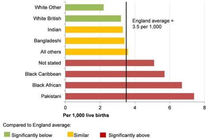 What ethnic group has the highest rate of birth defects?